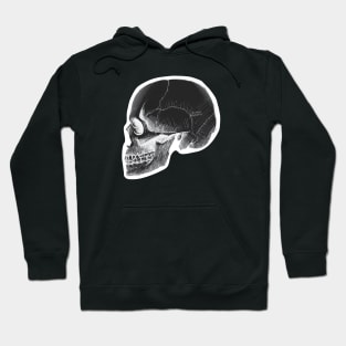 Negative Anatomy Skeleton Skull Hoodie